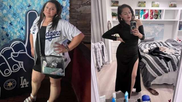Mariel Aguilar Ruiz Before After