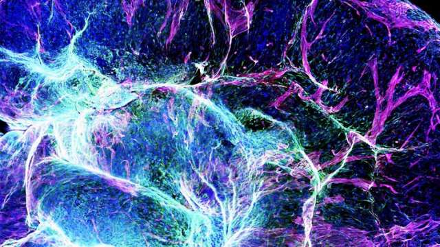 Vessel Organoid for Regenerative Medicine from DAPM Research Faculty, Dr. Mingxia Gu Lab