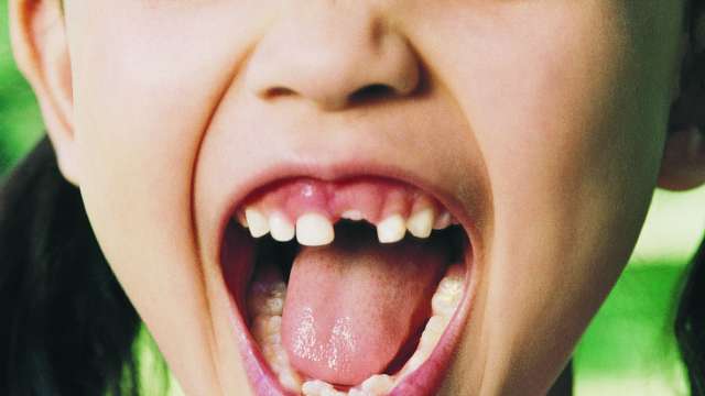 Oral health