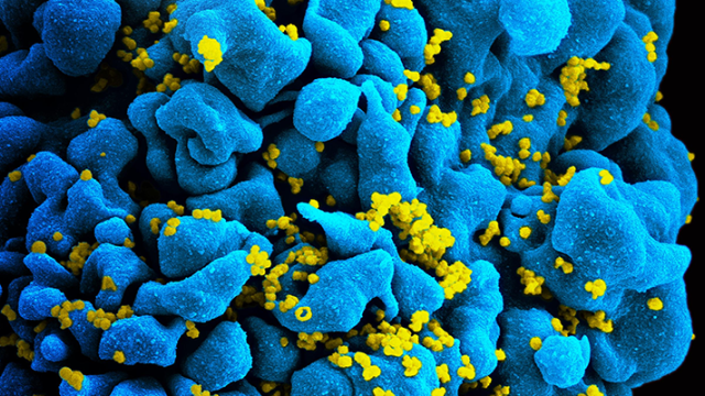 an illustration of CAR T cells attack HIV infected cells 