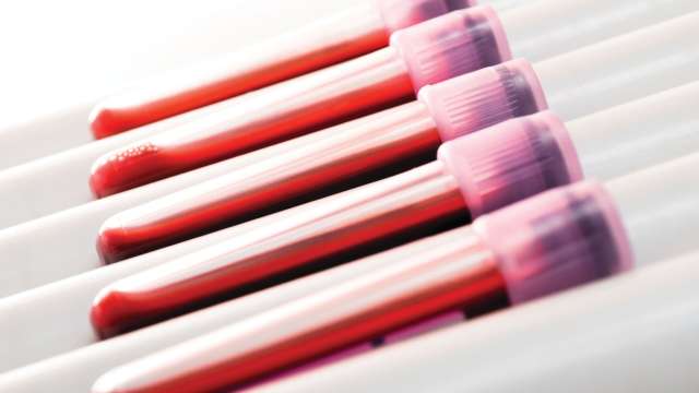 Test tubes and screening