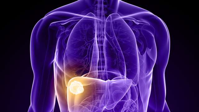 Liver Tumors