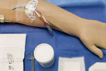 Peripherally Inserted Central Catheters (PICC)