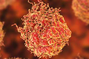 Prostate cancer cell