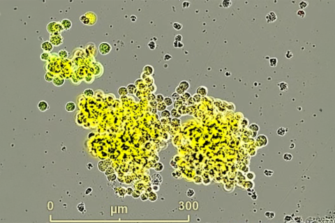 Small cell neuroendocrine prostate cancer model