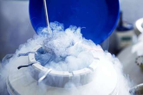 The study found that the number of planned elective egg freezing cycles nearly quadrupled between 2014 and 2021