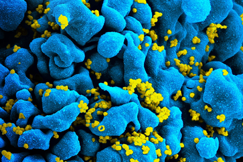an illustration of CAR T cells attack HIV infected cells 