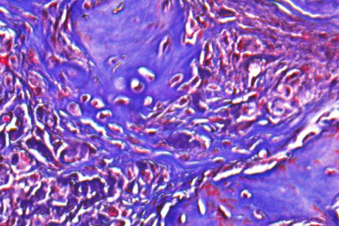  Microscopic image of regenerated bone tissue, showing a complex network of interconnected bone structures in various shades of red and purple, from the Min Lee Lab at UCLA Health.
