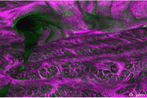 second harmonic generation