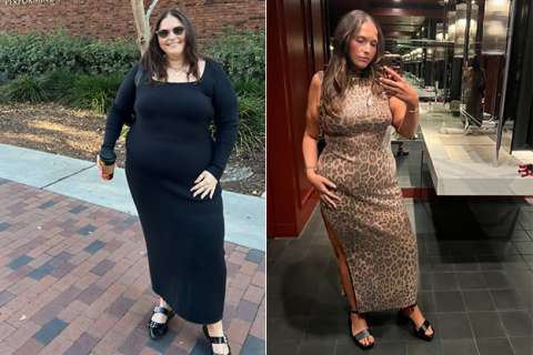 Simonne before and after Gastric Sleeve surgery at UCLA Health