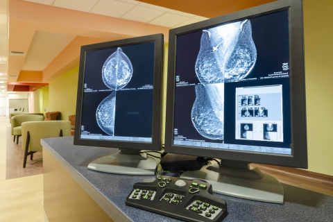 Breast scans on computer screens.
