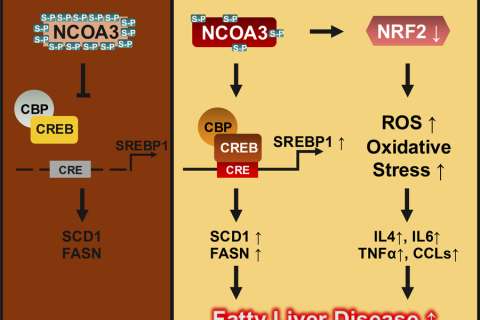 ULK1 repression linked to MASLD causing fatty liver, inflammation and fibrosis