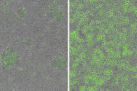 a microscopic graphic of the before and after of CAR T cell therapy