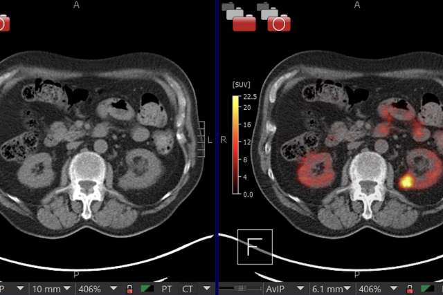 CA9 Scan