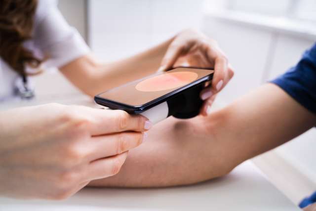 Doctor examines a patient for potential melanoma