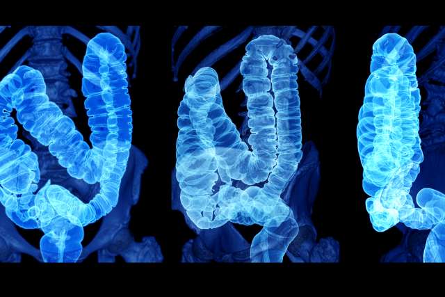 Collection of CT colonography scan images.