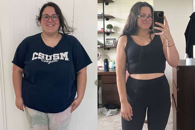 Joanna's Story - Before and After Roux-en-Y Gastric Bypass Surgery