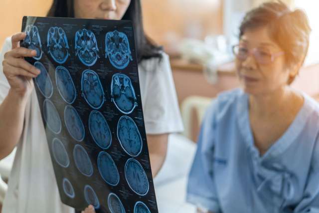 stroke xray