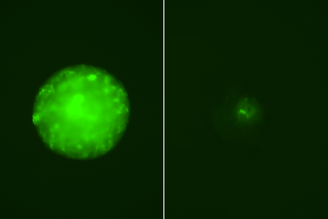 Glioblastoma cells