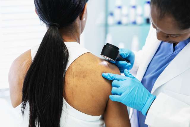 Black female doctor patient melanoma skin exam