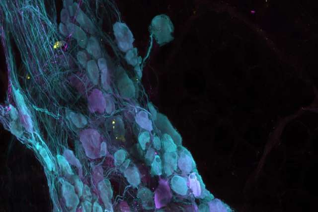 image of an heart artery with covid