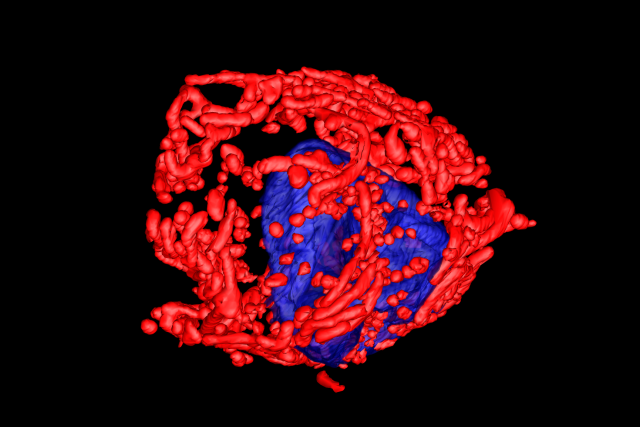 Mitochondrial cells surrounding the nucleus of a cancer cell 