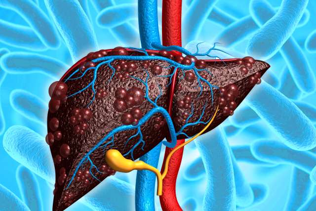 Liver Disease Microbiome