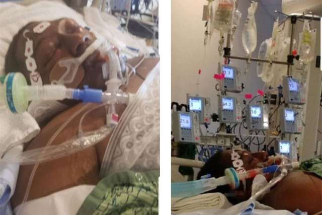 Close-up of Jonathan Cosby connected to medical equipment