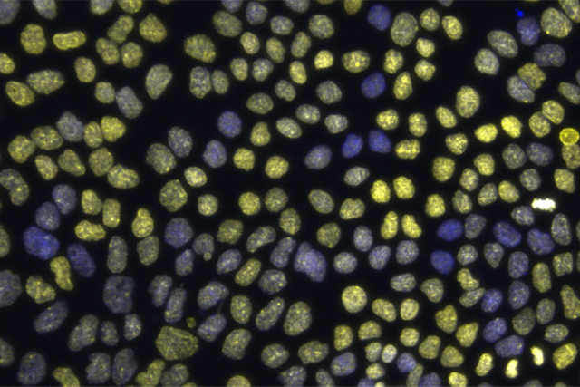 epithelial chromatin variation