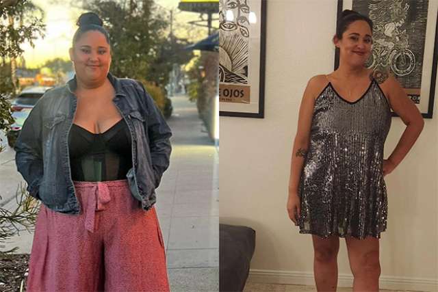 Vanessa before and after Gastric Sleeve Surgery at UCLA
