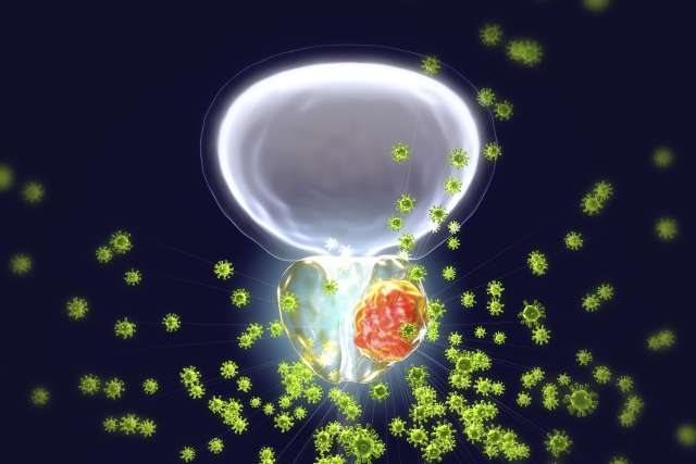 Prostate cancer cells