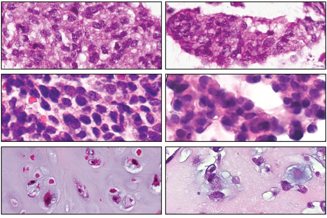 Microscopy panels displaying stained cancer cell samples under varying conditions for histopathologic and diagnostic comparison.