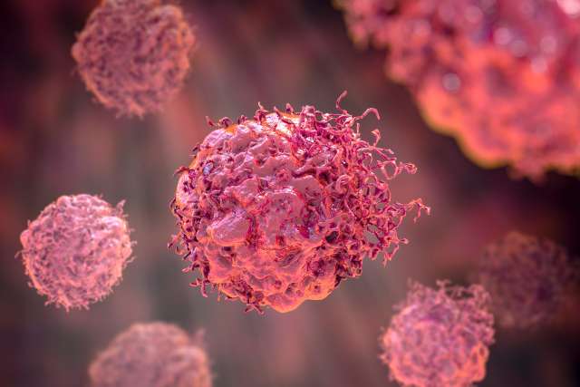 Cancer Cells