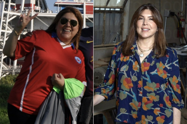 Lorena's Story - Before and After Gastric Sleeve Surgery at UCLA