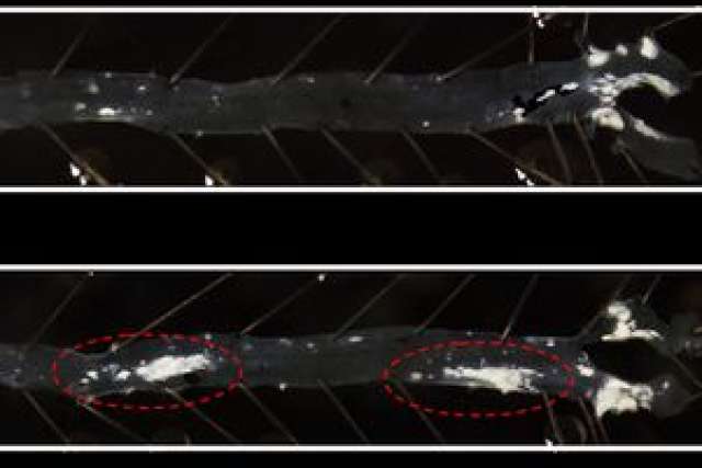  Two side-by-side images of an artery. The bottom image highlights two areas of plaque buildup with red dashed ovals.