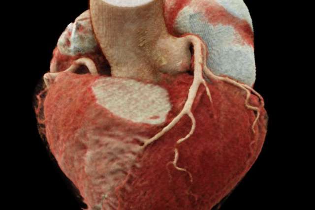 Cinematic Rendering of the Heart