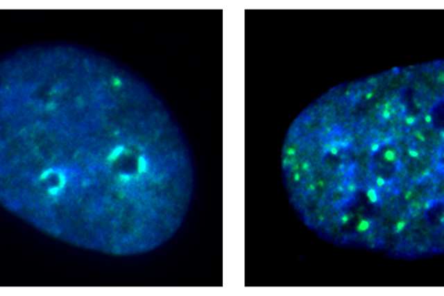 Images of cells with and without KDM4A