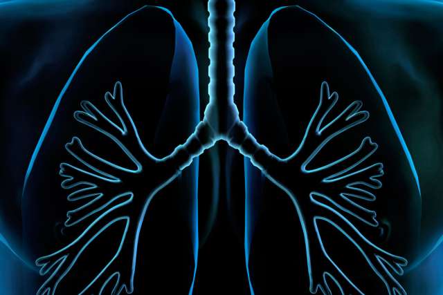 Lung Illustration, X-ray