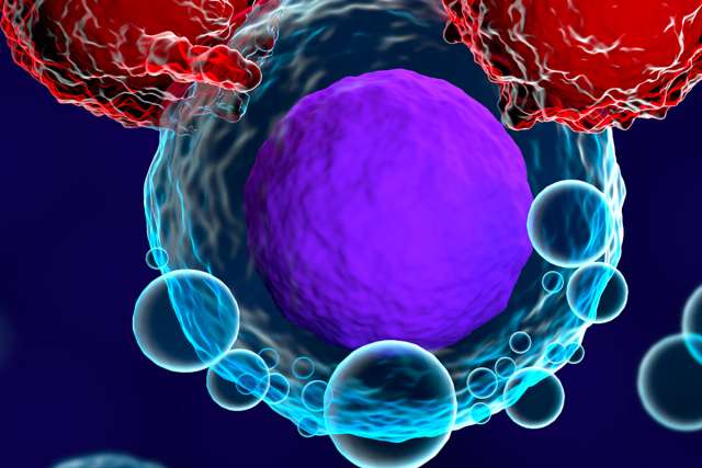 CAR T-cell Therapy