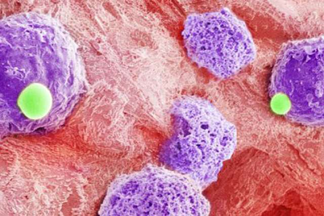 Hematopoietic stem cells and blood plasma joined together