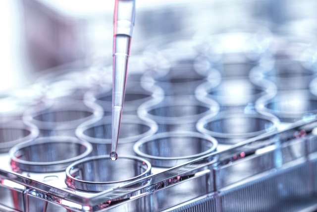 Pipette and test tubes