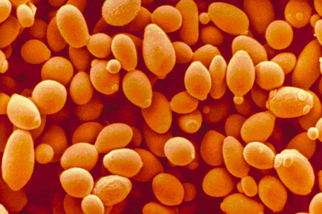 What yeast can tell us