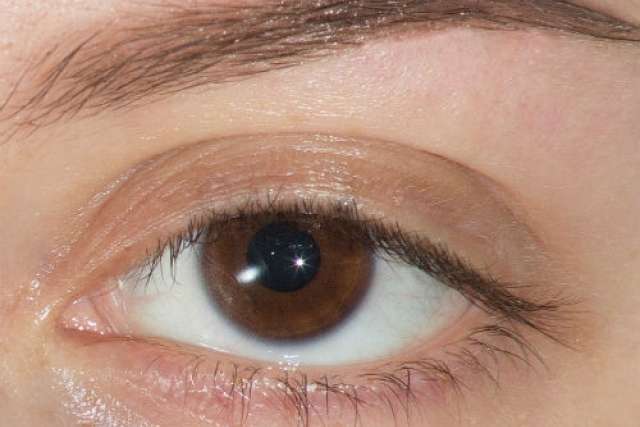 Close-up of brown eye with slightly drooping upper eyelid