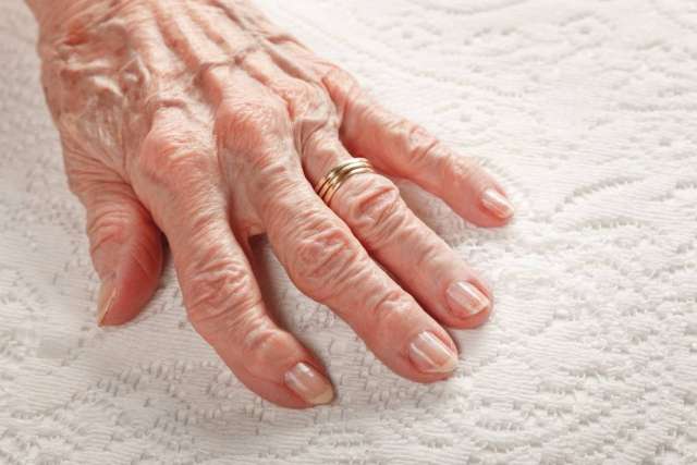 Ederly hand wearing a wedding ring on white quilted fabric