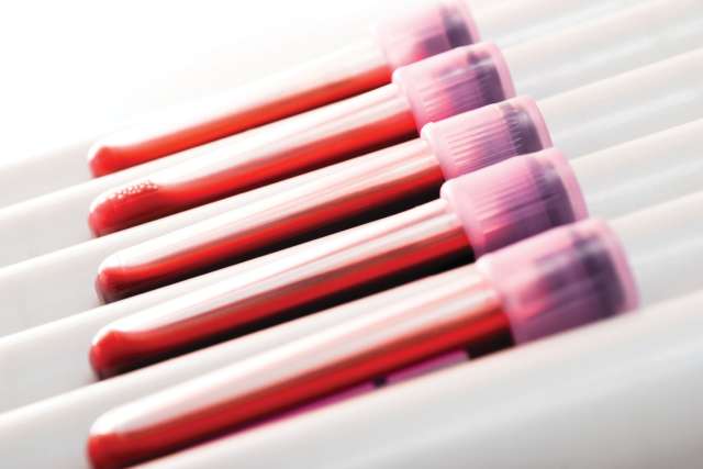 Test tubes and screening