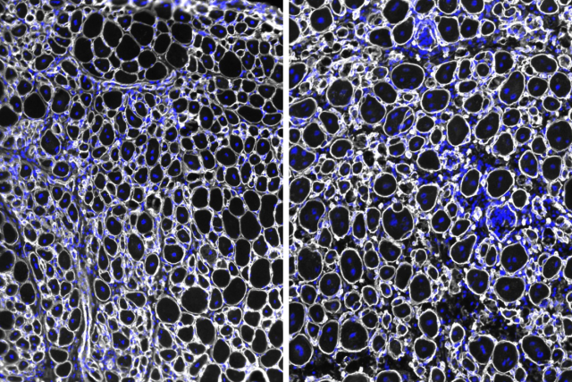 Side by side microscopy image of muscle tissue from aged mice seven days after injury shown in blue, white and black