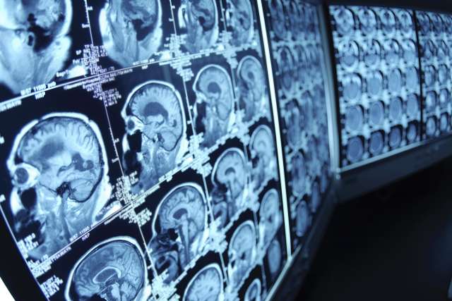 Brain Scans
