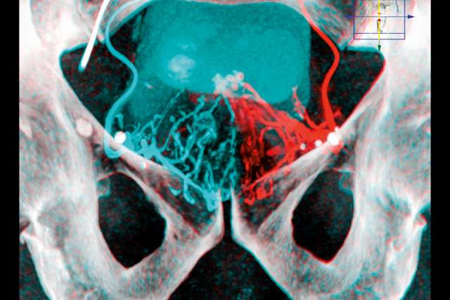 Pelvis x-ray
