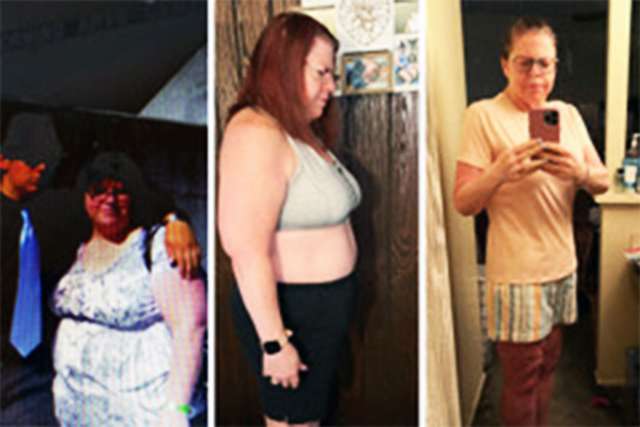 Darla before and after Gastric Sleeve Surgery at UCLA