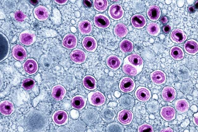 CMV particles